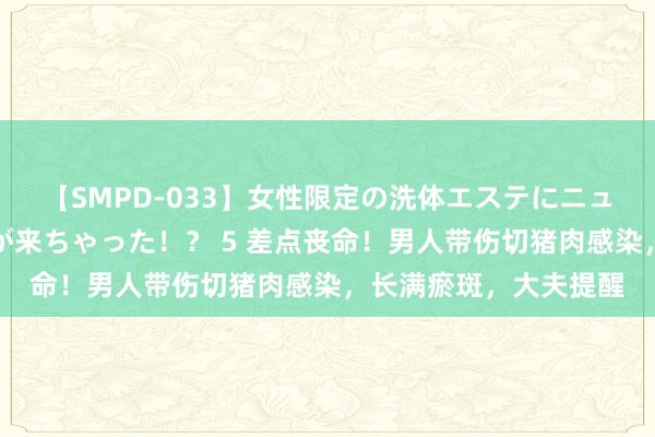 【SMPD-033】女性限定の洗体エステにニューハーフのお客さんが来ちゃった！？ 5 差点丧命！男人带伤切猪肉感染，长满瘀斑，大夫提醒
